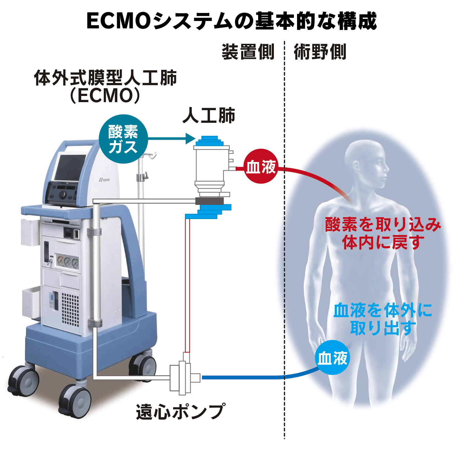患者運動　長　宏 走るICU」で重症患者を救え コロナ搬送、緊迫の現場 - 日本経済新聞